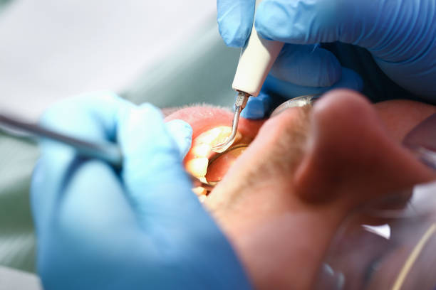 Best Weekend Emergency Dentist in Mount Vernon, IA